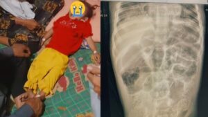 68a5796acb3c8-balita-meninggal-dipenuhi-cacing_banyumas